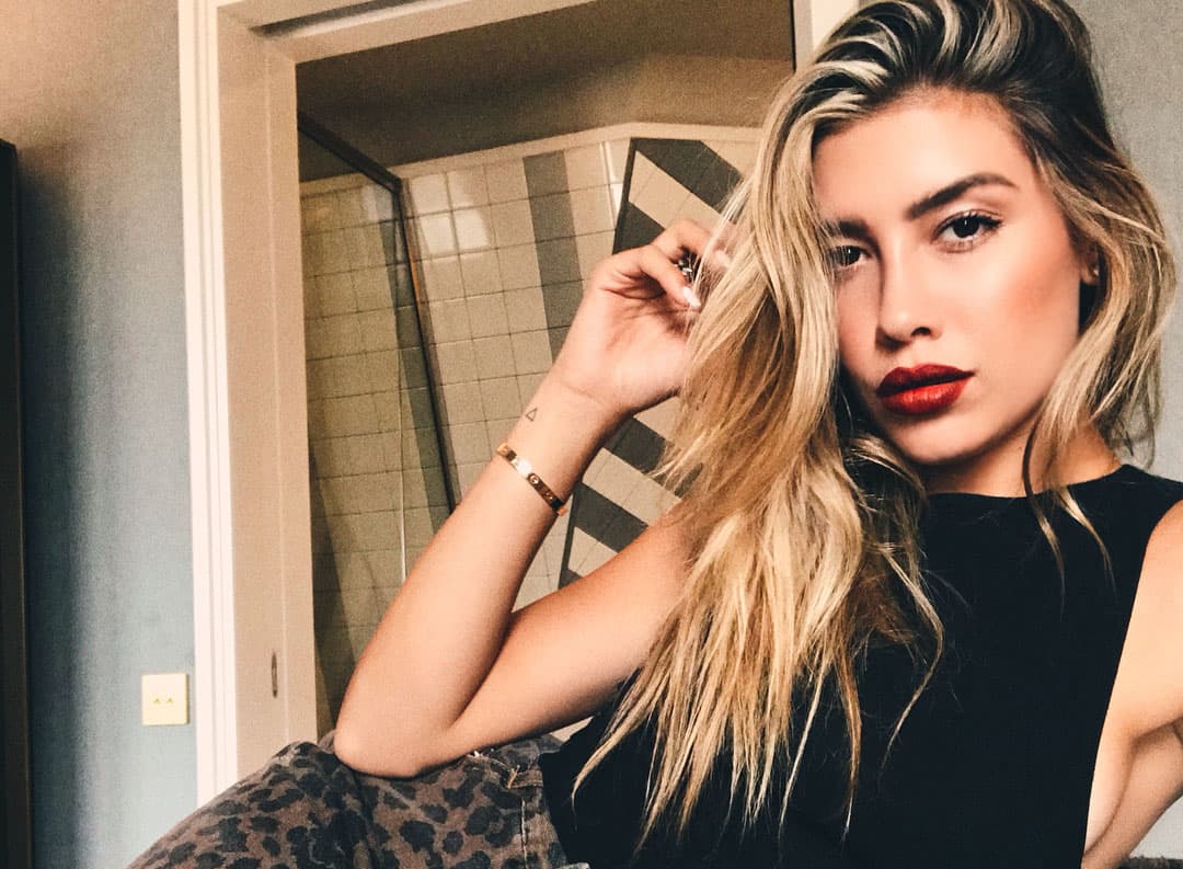 Michelle Salas reaparece tras sufrir aparatoso accidente y revela que tendrá que ser operada
